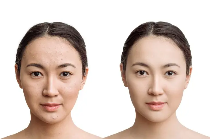 How AI Skin Retouching is Transforming Photography: Flawless Faces